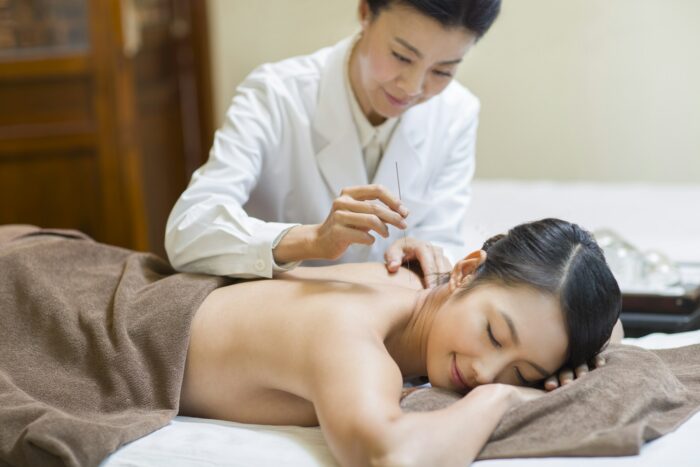 Young woman receiving acupuncture