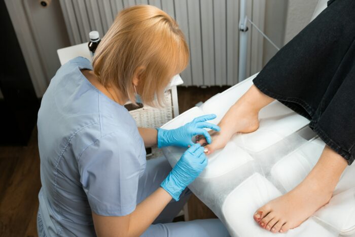 Top view of female podiatrist performs the procedure of ingrown nail removal using nippers